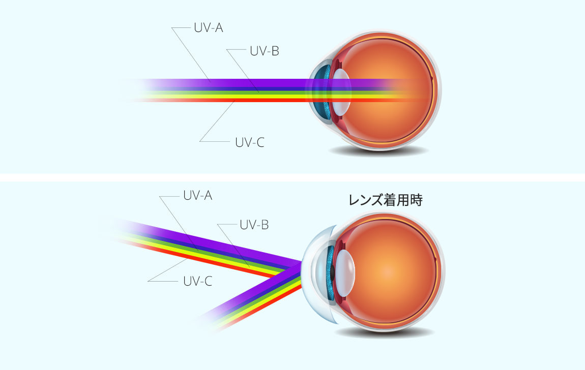 UV blocking by lens